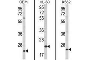 Western blot analysis of KLRC2 Antibody (N-term) from left to right in CEM, HL-60, K562 cell line lysates (35ug/lane). (KLRC2 anticorps  (N-Term))