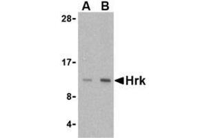 Western blot analysis of Hrk in mouse pancreas tissue lysate with AP30395PU-N Hrk antibody at (A) 2.