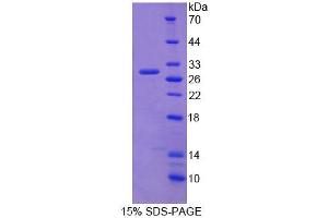 SDS-PAGE (SDS) image for Core-Binding Factor, beta Subunit (CBFB) (AA 1-187) protein (His tag) (ABIN4989192) (CBFB Protein (AA 1-187) (His tag))