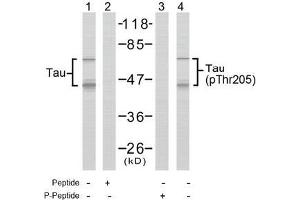 Image no. 2 for anti-Microtubule-Associated Protein tau (MAPT) (pThr205) antibody (ABIN196803) (MAPT anticorps  (pThr205))