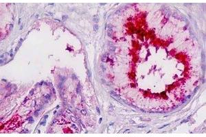 Human Pancreatic Duct: Formalin-Fixed, Paraffin-Embedded (FFPE) (PLA2G7 anticorps)