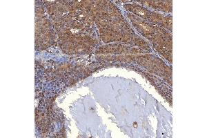 IHC analysis of PIG3/TP53I3 using anti-PIG3/TP53I3 antibody (ABIN7599280). (TP53I3 anticorps  (AA 1-332))