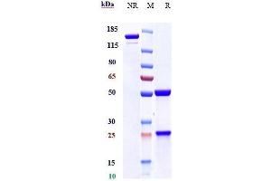 Anti-Mesothelin Reference Antibody (amatuximab) on SDS-PAGE under reducing (R) condition. (Recombinant Mesothelin (Amatuximab Biosimilar) anticorps)