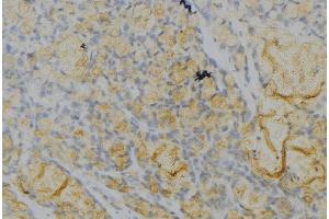 ABIN6277107 at 1/100 staining Human gastric tissue by IHC-P.