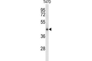 Western Blotting (WB) image for anti-Ceroid-Lipofuscinosis, Neuronal 5 (CLN5) antibody (ABIN3003962) (CLN5 anticorps)