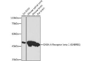 Western blot analysis of extracts of various cell lines, using GABA A Receptor beta 1 (G) (G) Rabbit mAb (ABIN7267345) at 1:1000 dilution. (GABRB1 anticorps)