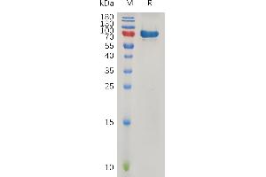 Human SPARC Protein, hFc Tag on SDS-PAGE under reducing condition.