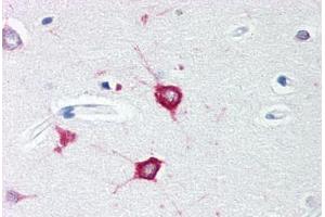 anti-Toll Interacting Protein (TOLLIP) (C-Term) antibody