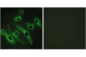 Immunofluorescence analysis of HeLa cells, using HER2 Antibody. (ErbB2/Her2 anticorps  (AA 641-690))