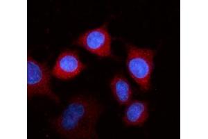 IF analysis of Fibrinogen beta chain/FGB using anti-Fibrinogen beta chain/FGB antibody (ABIN4886579). (Fibrinogen beta Chain anticorps  (Middle Region))