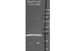 Goat anti antibody  was used to detect purified Beta Phospho Glucomutase under reducing (R) and non-reducing (NR) conditions. (Beta-Phosphoglucomutase anticorps  (Biotin))