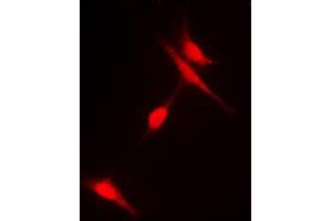 Immunofluorescent analysis of Histone Deacetylase 6 (pS22) staining in Hela cells. (HDAC6 anticorps  (N-Term, pSer22))