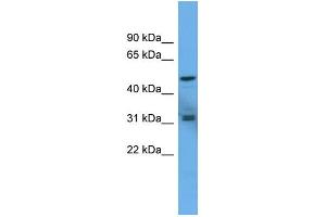 WB Suggested Anti-ADCYAP1R1 Antibody Titration: 0. (ADCYAP1R1 anticorps  (C-Term))