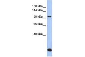 Image no. 1 for anti-Major Vault Protein (MVP) (N-Term) antibody (ABIN6744297) (MVP anticorps  (N-Term))