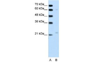 RGS4 antibody used at 1 ug/ml to detect target protein.