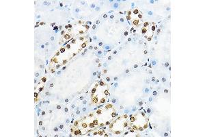 Immunohistochemistry of paraffin-embedded rat kidney using NR5 Rabbit pAb (ABIN6127421, ABIN6144833, ABIN6144835 and ABIN6221444) at dilution of 1:100 (40x lens). (NR5A2 + LRH1 anticorps  (AA 206-495))