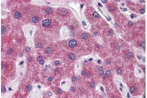 Human Liver: Formalin-Fixed, Paraffin-Embedded (FFPE)