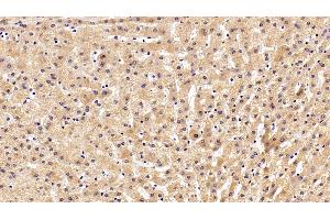 Detection of TF in Porcine Liver Tissue using Polyclonal Antibody to Transferrin (TF) (Transferrin anticorps  (AA 361-683))