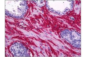 Immunohistochemistry (IHC) image for anti-Collagen, Type I (COL1) antibody (ABIN782308)