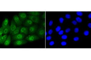 HepG2 cells were stained with Smad5(S463/465) (1B8) Monoclonal Antibody  at [1:200] incubated overnight at 4C, followed by secondary antibody incubation, DAPI staining of the nuclei and detection. (SMAD5 anticorps  (pSer463, pSer465))