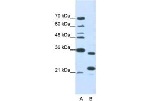 Western Blotting (WB) image for anti-AlkB, Alkylation Repair Homolog 8 (ALKBH8) antibody (ABIN2462330) (ALKBH8 anticorps)