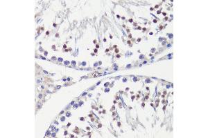 Immunohistochemistry of paraffin-embedded rat testis using HFM1 antibody (ABIN6133318, ABIN6141741, ABIN6141743 and ABIN6224711) at dilution of 1:100 (40x lens). (HFM1 anticorps  (AA 1-240))