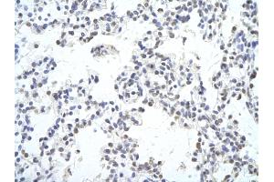 Rabbit Anti-MAF Antibody Catalog Number: ARP38608_P050  Paraffin Embedded Tissue: Human Lung cell  Cellular Data: Epithelial cells of renal tubule Antibody Concentration:  4. (MAF anticorps  (C-Term))
