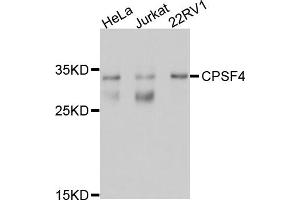 Western blot analysis of extracts of various cell lines, using CPSF4 antibody (ABIN5997508) at 1/1000 dilution.