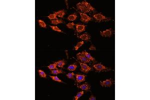 Immunofluorescence analysis of C6 cells using PASK antibody (ABIN6128413, ABIN6145248, ABIN6145249 and ABIN6224850) at dilution of 1:100. (PASK anticorps  (AA 1194-1323))