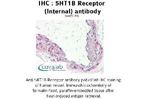 Image no. 2 for anti-Serotonin Receptor 1B (HTR1B) (Internal Region) antibody (ABIN1731348)