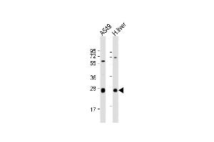 All lanes : Anti-TRH Antibody (C-Term) at 1:2000 dilution Lane 1: A549 whole cell lysate Lane 2: human liver lysate Lysates/proteins at 20 μg per lane. (TRH anticorps  (AA 157-191))