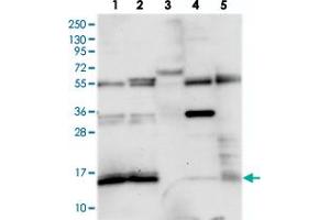 Western blot analysis of Lane 1: RT-4, Lane 2: U-251 MG, Lane 3: Human Plasma, Lane 4: Liver, Lane 5: Tonsil with FAM103A1 polyclonal antibody  at 1:250-1:500 dilution. (FAM103A1 anticorps)