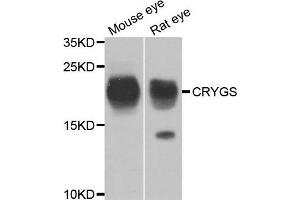 Western blot analysis of extracts of mouse eye and rat eye, using CRYGS antibody. (CRYGS anticorps)