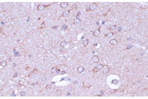 Immunohistochemistry of paraffin-embedded Rat brain using PRKACB Polyclonal Antibody at dilution of 1:100 (40x lens).