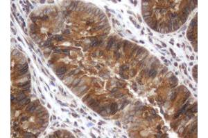 Image no. 3 for anti-Signal Recognition Particle Receptor, B Subunit (SRPRB) antibody (ABIN1501128) (SRPRB anticorps)