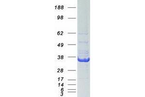 Validation with Western Blot