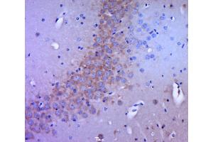 Paraformaldehyde-fixed, paraffin embedded mouse brain tissue; Antigen retrieval by boiling in sodium citrate buffer (pH6.