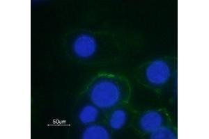 Expression of α1B-Adrenoceptor in rat GH3 cells - Cell surface detection of α1B-Adrenoceptor in GH3 cells with Anti-α1B-Adrenergic Receptor (extracellular)-ATTO Fluor-488 Antibody (ABIN7042898) (green).
