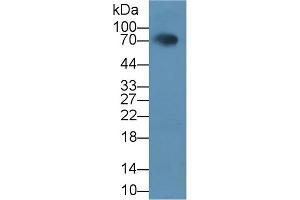 Detection of HCAM in Rat Serum using Polyclonal Antibody to Homing Associated Cell Adhesion Molecule (HCAM) (HCAM (AA 24-182) anticorps)