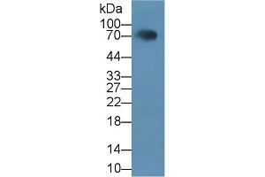 Detection of HCAM in Rat Serum using Polyclonal Antibody to Homing Associated Cell Adhesion Molecule (HCAM) (HCAM anticorps  (AA 24-182))