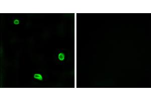 Immunofluorescence analysis of LOVO cells, using R4 antibody. (F2RL3 anticorps)