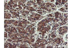 Image no. 2 for anti-Prefoldin Subunit 3 (PFDN3) antibody (ABIN1501704)