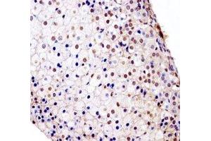 Fgfr1 antibody immunohistochemistry analysis in formalin fixed and paraffin embedded mouse adrenal glands.