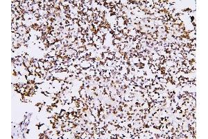 IHC analysis of PHF21A using anti-PHF21A antibody (ABIN6719353). (PHF21A anticorps  (AA 1-97))