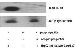 Western Blotting (WB) image for anti-Discoidin Domain Receptor tyrosine Kinase 1 (DDR1) (pTyr513) antibody (ABIN3173324) (DDR1 anticorps  (pTyr513))