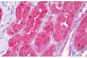 Anti-HIP1 antibody IHC staining of human kidney, tubules. (HIP1 anticorps  (AA 928-1038))