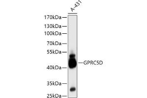 Western blot analysis of extracts of A-431 cells, using GPRC5D antibody (ABIN7267317) at 1:1000 dilution. (GPRC5D anticorps  (AA 264-345))