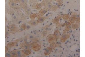 Detection of CK18 in Human Liver Tissue using Polyclonal Antibody to Cytokeratin 18 (CK18)