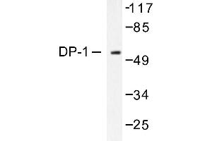 Image no. 1 for anti-Transcription Factor Dp-1 (TFDP1) antibody (ABIN265387) (DP1 anticorps)