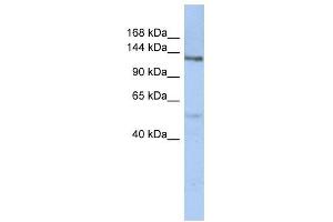 CHSY2 antibody used at 1 ug/ml to detect target protein. (CHPF anticorps  (N-Term))